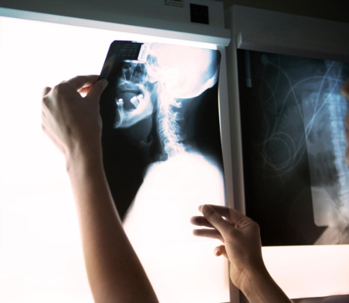 Person hanging up x-ray