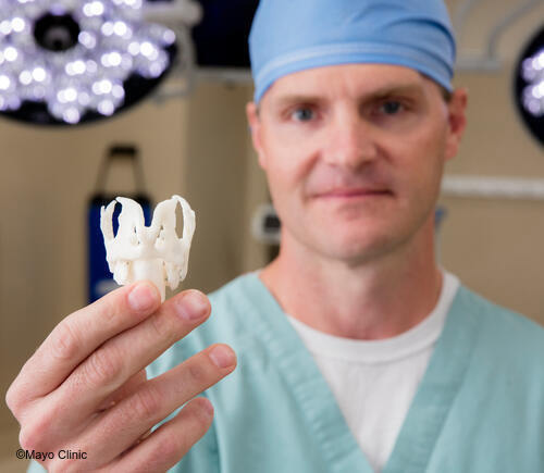 Doctor holding a 3D printed larynx