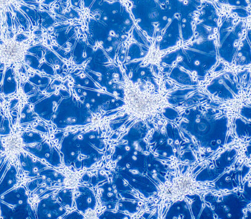 Blue cells under microscope