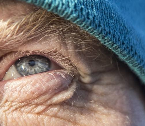 Closeup of an eye