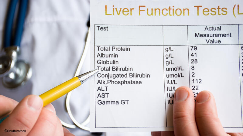 Liver test printout