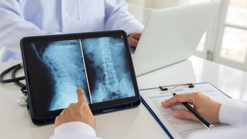 Spine x-rays