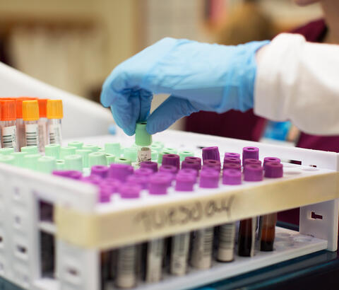 Tray of test tubes in lab