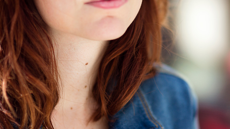 Image of moles on a woman's neck