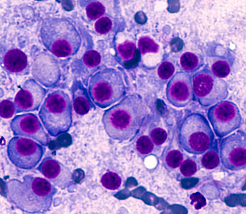 Purple multiple myeloma cells