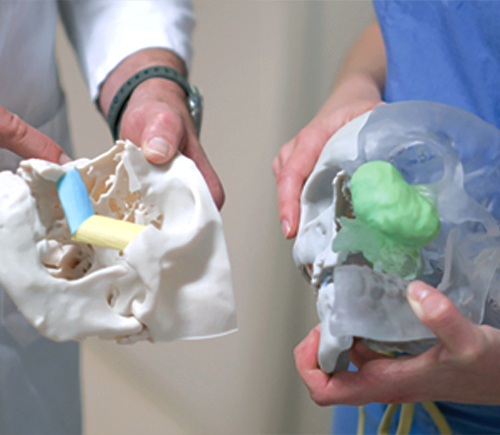 3D printed skulls