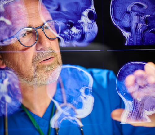 Doctor looking at scans