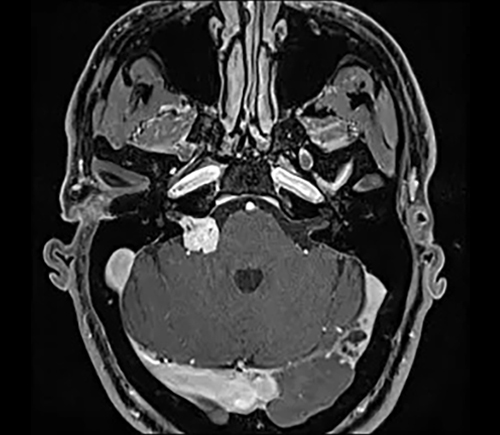 MRI image of a human head