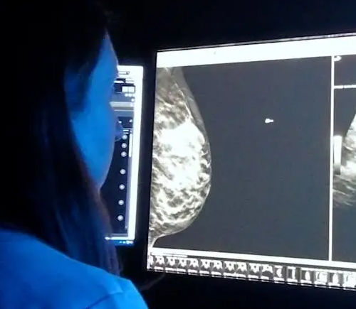 Person reviewing breast scans